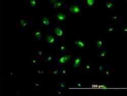 ATP2C1 Antibody, Novus Biologicals 0.05 mg | Buy Online | Novus Biologicals | Fisher Scientific
