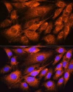 ATP5D Antibody - BSA Free, Novus Biologicals 0.02 mL | Buy Online | Novus Biologicals | Fisher Scientific