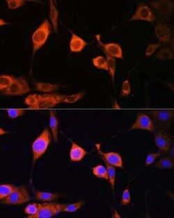 ATP5D Antibody - BSA Free, Novus Biologicals 0.02 mL | Buy Online | Novus Biologicals | Fisher Scientific