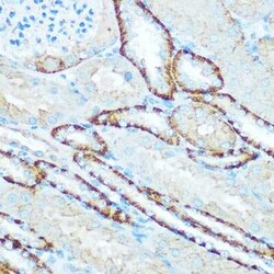 ATP5H Antibody - BSA Free, Novus Biologicals:Antibodies:Primary Antibodies