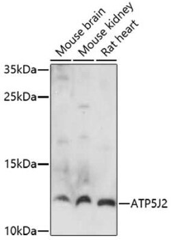 ATP5J2 Antibody - Azide and BSA Free, Novus Biologicals 0.1 mL | Buy Online | Novus Biologicals | Fisher Scientific