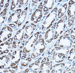 ATP5O Antibody - BSA Free, Novus Biologicals 0.1 mL, Unconjugated:Antibodies,
