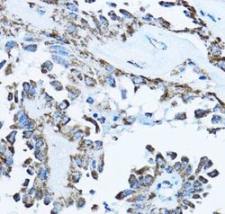 ATP5O Antibody - BSA Free, Novus Biologicals 0.1 mL, Unconjugated:Antibodies,