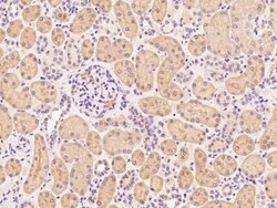 ATP6V0A2 Antibody, Novus Biologicals 50 &mu;g; Unconjugated:Antibodies,