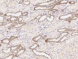 ATP6V0A4 Antibody, Novus Biologicals:Antibodies:Primary Antibodies