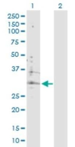 ATP6V0B Antibody, Novus Biologicals 0.1 mg; Unconjugated:Antibodies, Polyclonal