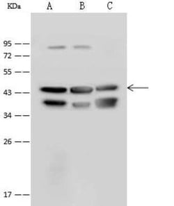 ATP6V0D1 Antibody, Novus Biologicals 100 &mu;g; Unconjugated:Antibodies,