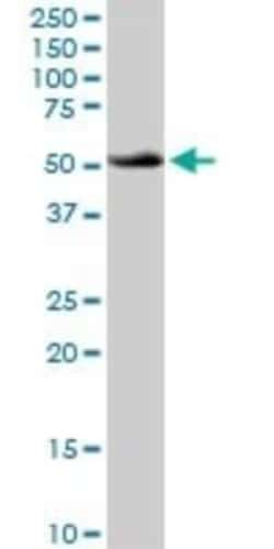 ATP6V1B1 Antibody, Novus Biologicals 0.1 mg | Buy Online | Novus Biologicals | Fisher Scientific
