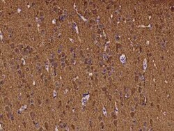 ATP6V1B2 Antibody, Novus Biologicals 50 &mu;g, Unconjugated:Anticuerpos