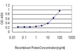 ATP6V1B2 Antibody (M1), Novus Biologicals 0.1 mg | Buy Online | Novus Biologicals | Fisher Scientific