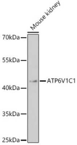 ATP6V1C1 Antibody - Azide and BSA Free, Novus Biologicals:Antibodies:Primary