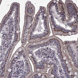 ATP6V1C2 Antibody, Novus Biologicals 25ul; Unconjugated:Antibodies, Polyclonal