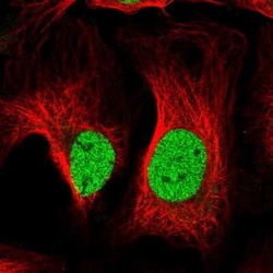 ATP6V1D Antibody, Novus Biologicals:Antibodies:Primary Antibodies