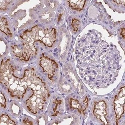 ATP6V1D Antibody, Novus Biologicals:Antibodies:Primary Antibodies