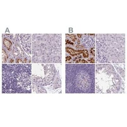 ATP6V1D Antibody, Novus Biologicals:Antibodies:Primary Antibodies