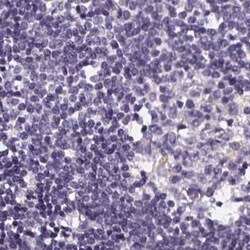 ATP6V1D Antibody, Novus Biologicals:Antibodies:Primary Antibodies