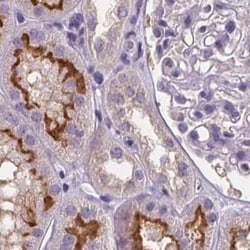 ATP6V1D Antibody, Novus Biologicals:Antibodies:Primary Antibodies
