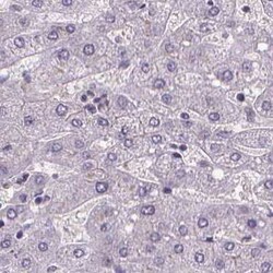 ATP6V1D Antibody, Novus Biologicals:Antibodies:Primary Antibodies