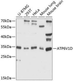 ATP6V1D Antibody - Azide and BSA Free, Novus Biologicals 0.02 mL | Buy Online | Novus Biologicals | Fisher Scientific
