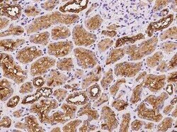 ATP6V1E1 Antibody, Novus Biologicals 100 &mu;g; Unconjugated:Antibodies,