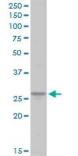 Novus Biologicals ATP6V1E1 Antibody, Novus Biologicals 0.1 mg | Buy Online | Novus Biologicals&trade; | Fisher Scientific