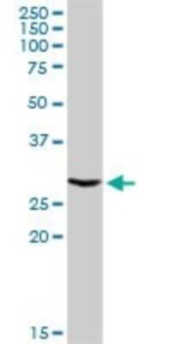 Novus Biologicals ATP6V1E1 Antibody, Novus Biologicals 0.1 mg | Buy Online | Novus Biologicals&trade; | Fisher Scientific