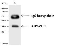 ATP6V1E1 Antibody, Novus Biologicals 100 &mu;g; Unconjugated:Antibodies,
