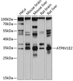 ATP6V1E2 Antibody - Azide and BSA Free, Novus Biologicals:Antibodies:Primary