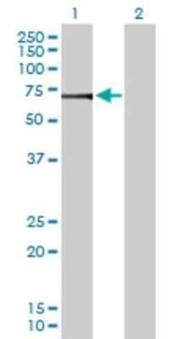 ATP6V1H Antibody, Novus Biologicals 0.1 mg | Buy Online | Novus Biologicals | Fisher Scientific