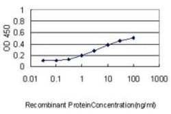 ATP7b Antibody (3E10), Novus Biologicals 0.1 mg, Unconjugated:Antibodies,