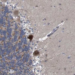 ATP7b Antibody, Novus Biologicals:Antibodies:Primary Antibodies