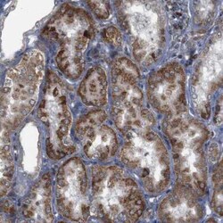 ATP7b Antibody, Novus Biologicals:Antibodies:Primary Antibodies