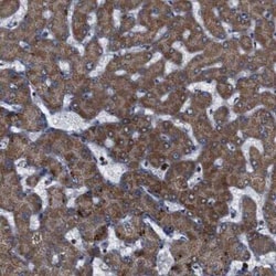 ATP7b Antibody, Novus Biologicals:Antibodies:Primary Antibodies