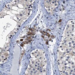 ATP7b Antibody, Novus Biologicals:Antibodies:Primary Antibodies