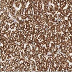 ATPB Antibody, Novus Biologicals:Antibodies:Primary Antibodies