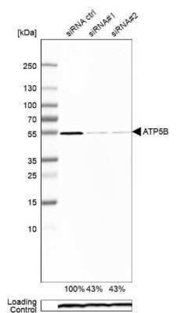 ATPB Antibody, Novus Biologicals:Antibodies:Primary Antibodies