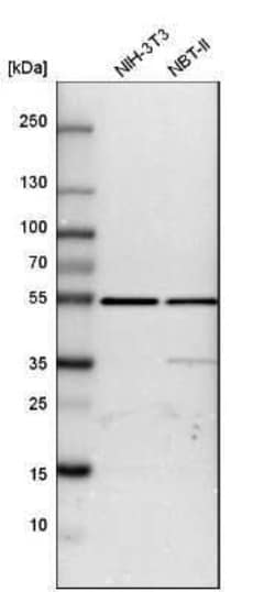 ATPB Antibody, Novus Biologicals:Antibodies:Primary Antibodies