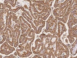ATPase Inhibitory Factor 1 Antibody, Novus Biologicals 50 &mu;g; Unconjugated:Antibodies,