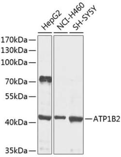 ATPase Na+/K+ beta 2 Antibody - BSA Free, Novus Biologicals:Antibodies:Primary
