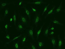 ATR Antibody, Novus Biologicals 50 &mu;g, Unconjugated:Antibodies, Polyclonal