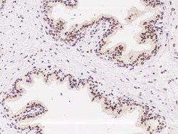 ATR Antibody, Novus Biologicals 50 &mu;g, Unconjugated:Antibodies, Polyclonal
