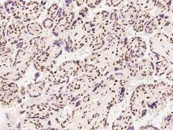ATXN7L1 Antibody, Novus Biologicals:Antibodies:Primary Antibodies