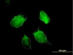 AUF1 Antibody, Novus Biologicals 0.05 mg; Unconjugated:Antikörper