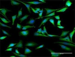 AUF1 Antibody, Novus Biologicals 0.1 mg | Buy Online | Novus Biologicals | Fisher Scientific