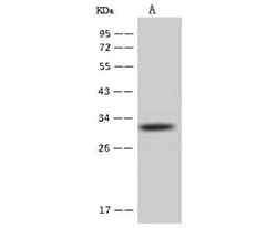 AUH Antibody, Novus Biologicals 100 &mu;g, Unconjugated:Antibodies, Polyclonal