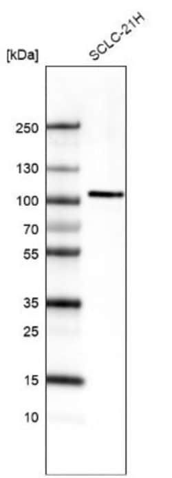 AUTS2 Antibody (CL7084), Novus Biologicals AUTS2 Antibody; Unconjugated;