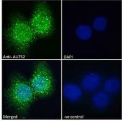 TATA binding protein TBP Rabbit anti-Human, Mouse, Rat, Polyclonal, Novus