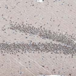 AUTS2 Antibody (CL7084), Novus Biologicals AUTS2 Antibody; Unconjugated;