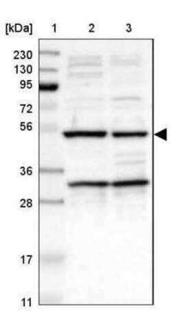 AVEN Antibody, Novus Biologicals 0.1 mL | Buy Online | Novus Biologicals | Fisher Scientific