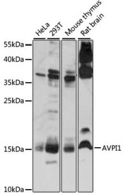 AVPI1 Antibody - Azide and BSA Free, Novus Biologicals 0.1 mL, Unconjugated:Antibodies,